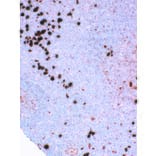 Immunohistochemistry - Anti-Lambda Light Chain Antibody [IHC709] (A324475) - Antibodies.com