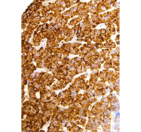 Immunohistochemistry - Anti-Luteinizing Hormone beta Antibody [IHC616] (A324476) - Antibodies.com