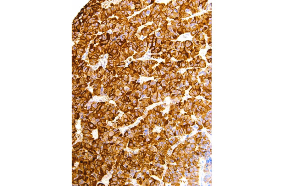 Immunohistochemistry - Anti-Luteinizing Hormone beta Antibody [IHC616] (A324476) - Antibodies.com