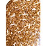 Immunohistochemistry - Anti-Luteinizing Hormone beta Antibody [IHC616] (A324476) - Antibodies.com