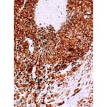 Immunohistochemistry - Anti-MelanA Antibody [IHC418] (A324477) - Antibodies.com