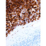 Immunohistochemistry - Anti-HMB-45 Antibody [IHC602] (A324478) - Antibodies.com