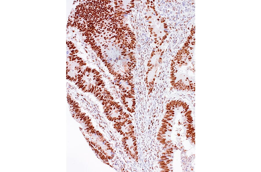 Immunohistochemistry - Anti-MSH2 Antibody [IHC510] (A324479) - Antibodies.com