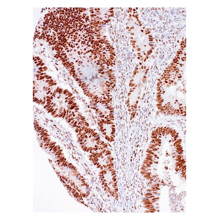 Immunohistochemistry - Anti-MSH2 Antibody [IHC510] (A324479) - Antibodies.com