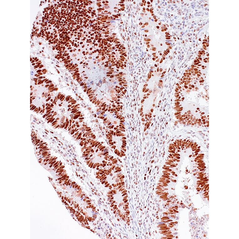 Immunohistochemistry - Anti-MSH2 Antibody [IHC510] (A324479) - Antibodies.com