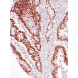 Immunohistochemistry - Anti-MSH2 Antibody [IHC510] (A324479) - Antibodies.com