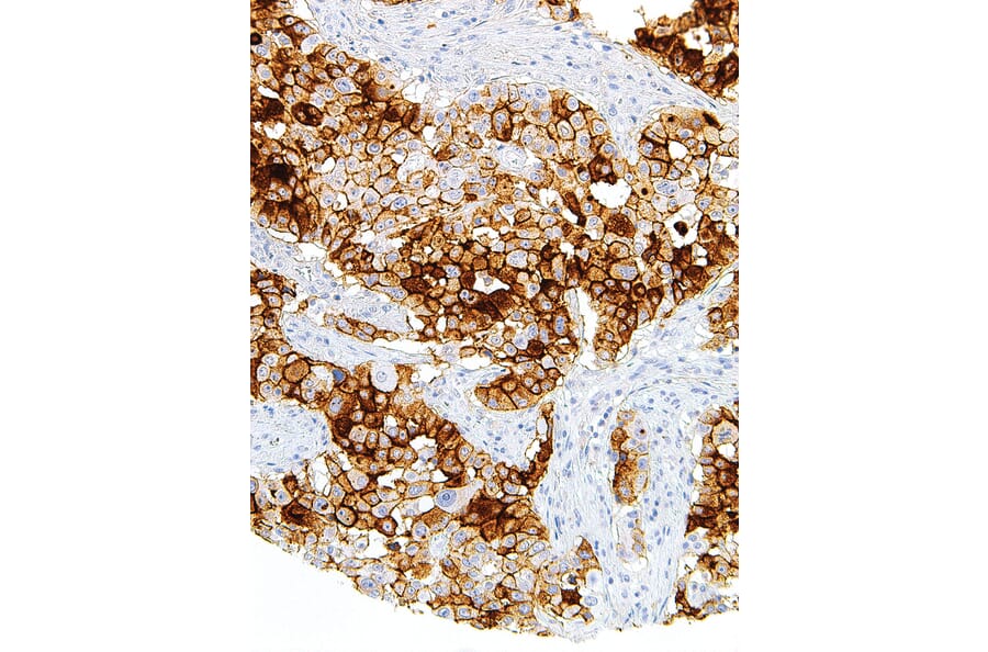 Immunohistochemistry - Anti-MUC16 Antibody [IHC125] (A324480) - Antibodies.com