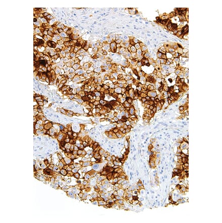 Immunohistochemistry - Anti-MUC16 Antibody [IHC125] (A324480) - Antibodies.com