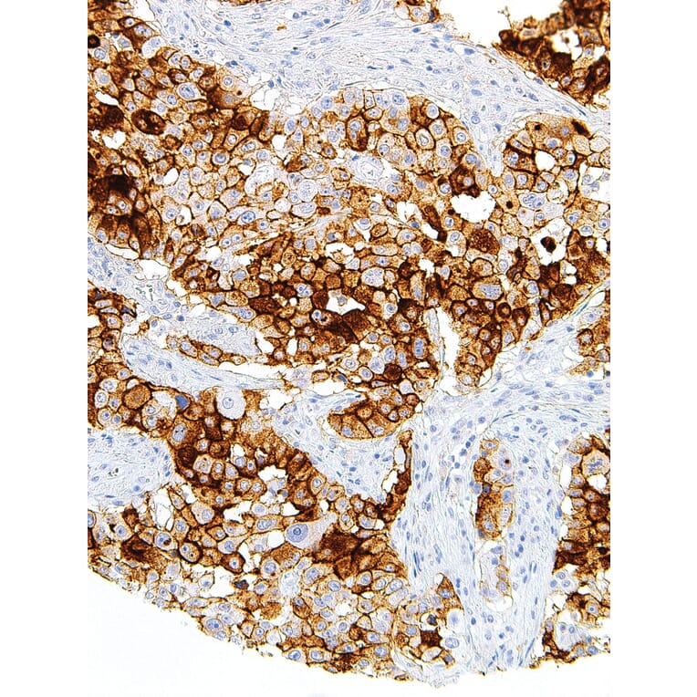 Immunohistochemistry - Anti-MUC16 Antibody [IHC125] (A324480) - Antibodies.com