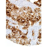 Immunohistochemistry - Anti-MUC16 Antibody [IHC125] (A324480) - Antibodies.com