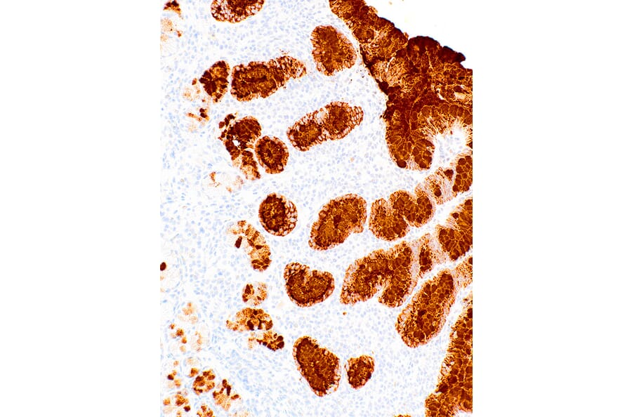 Immunohistochemistry - Anti-Mucin 5AC Antibody [IHC625] (A324481) - Antibodies.com