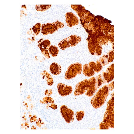 Immunohistochemistry - Anti-Mucin 5AC Antibody [IHC625] (A324481) - Antibodies.com
