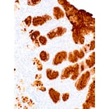 Immunohistochemistry - Anti-Mucin 5AC Antibody [IHC625] (A324481) - Antibodies.com