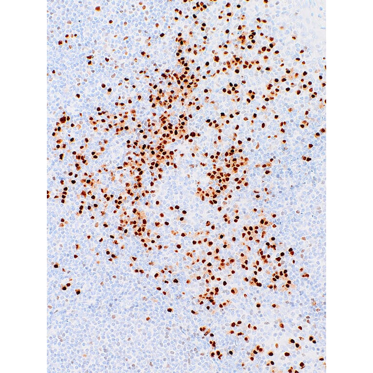 Immunohistochemistry - Anti-MUM1 Antibody [IHC627] (A324482) - Antibodies.com