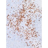 Immunohistochemistry - Anti-MUM1 Antibody [IHC627] (A324482) - Antibodies.com