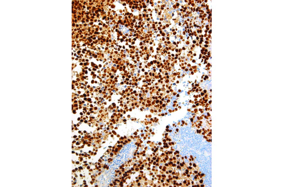 Immunohistochemistry - Anti-Myogenin Antibody [IHC631] (A324483) - Antibodies.com