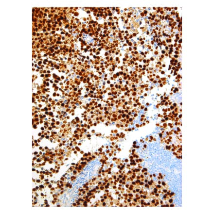 Immunohistochemistry - Anti-Myogenin Antibody [IHC631] (A324483) - Antibodies.com