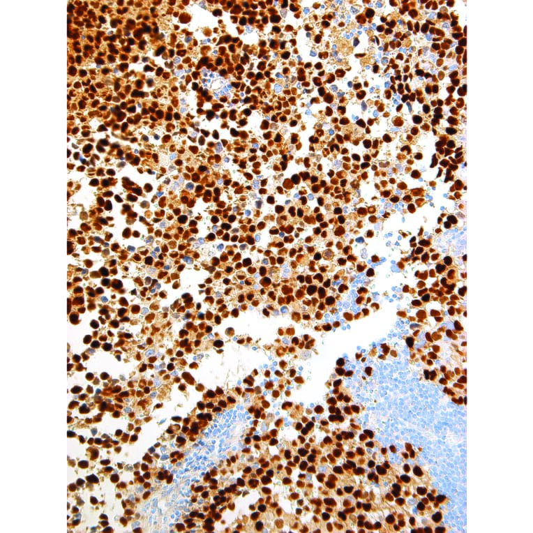 Immunohistochemistry - Anti-Myogenin Antibody [IHC631] (A324483) - Antibodies.com