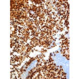 Immunohistochemistry - Anti-Myogenin Antibody [IHC631] (A324483) - Antibodies.com