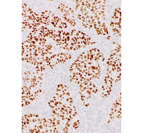 Immunohistochemistry - Anti-Nanog Antibody [IHC634] (A324484) - Antibodies.com