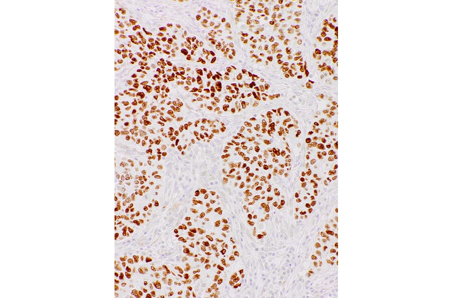 Immunohistochemistry - Anti-Nanog Antibody [IHC634] (A324484) - Antibodies.com