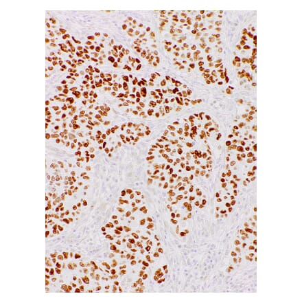 Immunohistochemistry - Anti-Nanog Antibody [IHC634] (A324484) - Antibodies.com