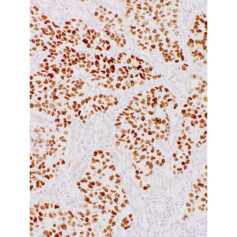 Immunohistochemistry - Anti-Nanog Antibody [IHC634] (A324484) - Antibodies.com