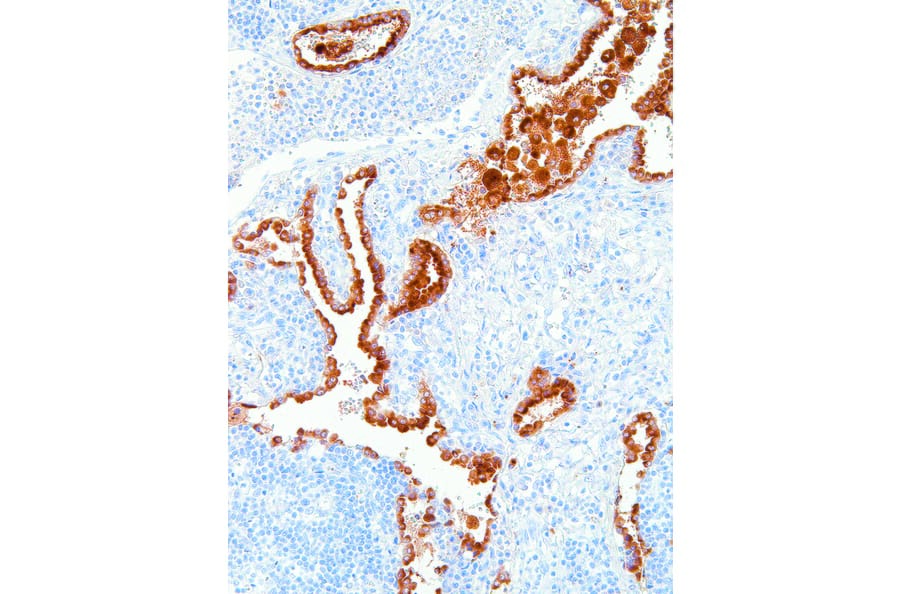 Immunohistochemistry - Anti-NAPSIN A Antibody [IHC635] (A324485) - Antibodies.com