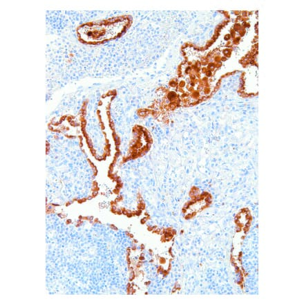 Immunohistochemistry - Anti-NAPSIN A Antibody [IHC635] (A324485) - Antibodies.com