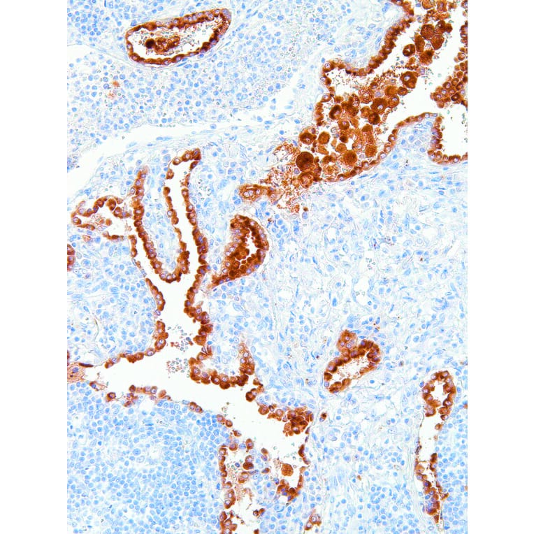 Immunohistochemistry - Anti-NAPSIN A Antibody [IHC635] (A324485) - Antibodies.com