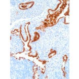 Immunohistochemistry - Anti-NAPSIN A Antibody [IHC635] (A324485) - Antibodies.com