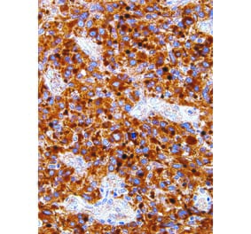 Immunohistochemistry - Anti-Neurofilament Antibody [IHC639] (A324486) - Antibodies.com