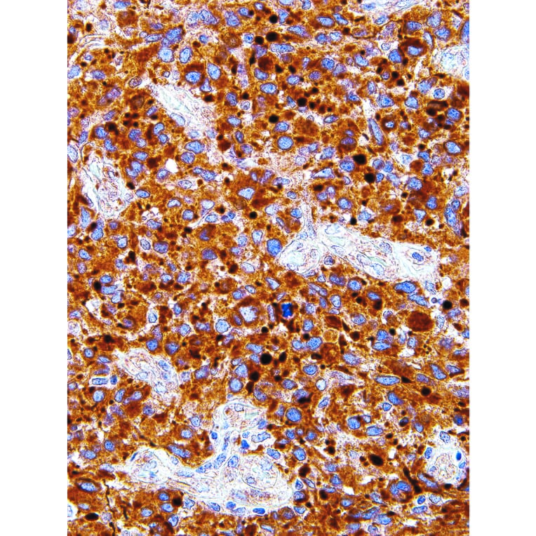 Immunohistochemistry - Anti-Neurofilament Antibody [IHC639] (A324486) - Antibodies.com