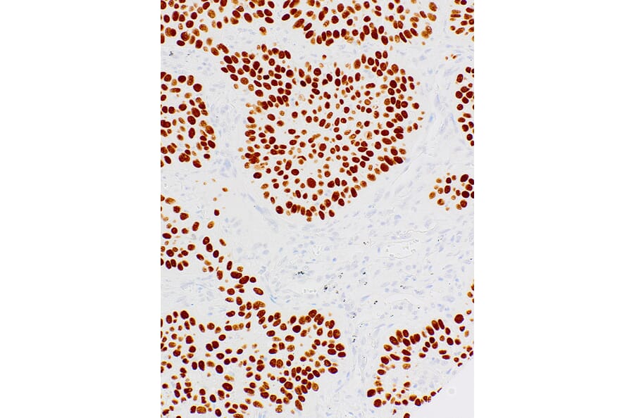 Immunohistochemistry - Anti-p40 Antibody [IHC058] (A324488) - Antibodies.com