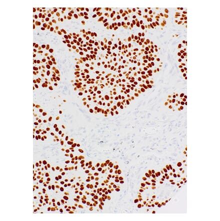 Immunohistochemistry - Anti-p40 Antibody [IHC058] (A324488) - Antibodies.com