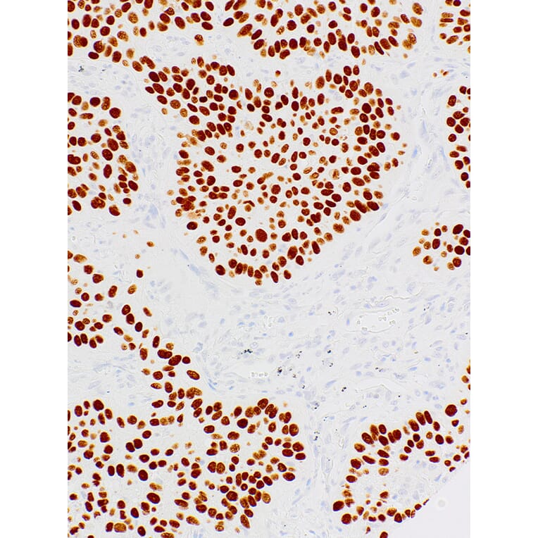 Immunohistochemistry - Anti-p40 Antibody [IHC058] (A324488) - Antibodies.com