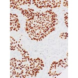 Immunohistochemistry - Anti-p40 Antibody [IHC058] (A324488) - Antibodies.com