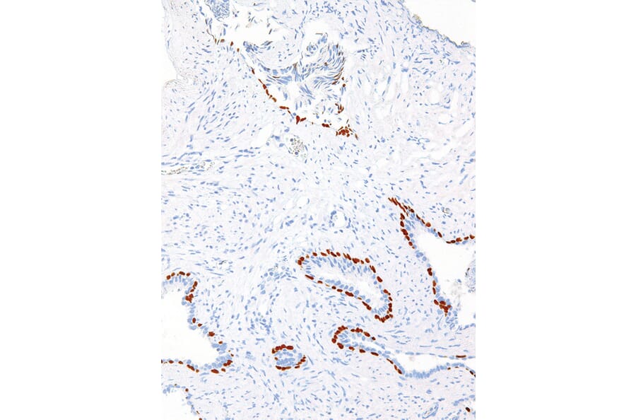 Immunohistochemistry - Anti-p63 Antibody [IHC063] (A324489) - Antibodies.com