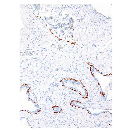 Immunohistochemistry - Anti-p63 Antibody [IHC063] (A324489) - Antibodies.com