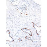 Immunohistochemistry - Anti-p63 Antibody [IHC063] (A324489) - Antibodies.com