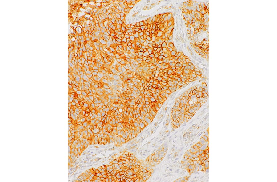 Immunohistochemistry - Anti-PD-L1 Antibody [IHC441] (A324490) - Antibodies.com