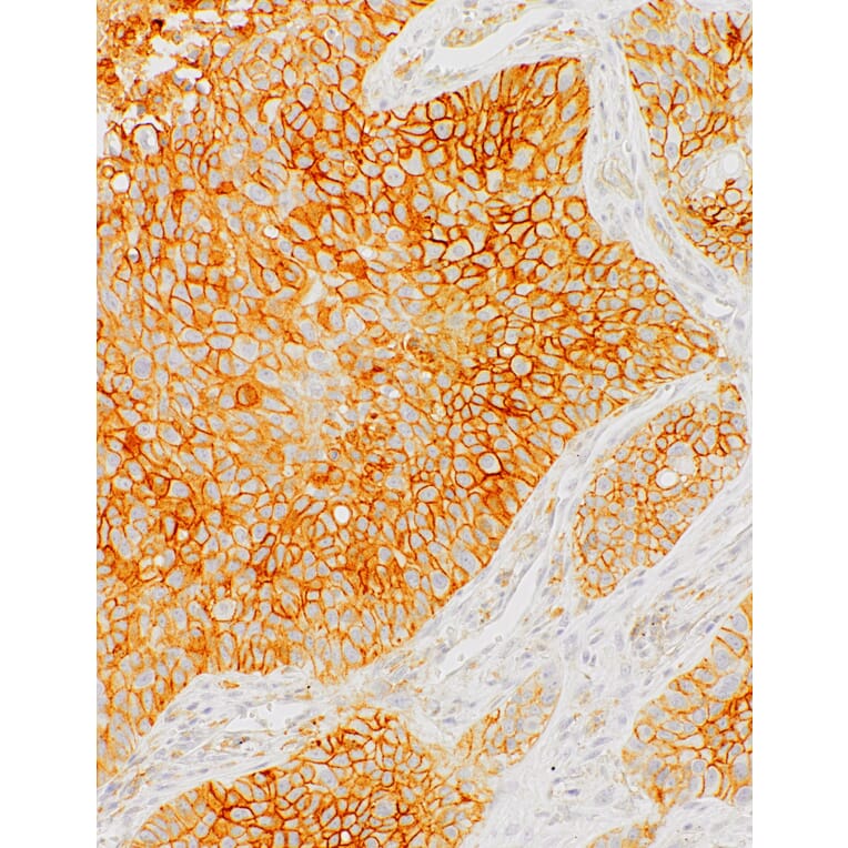 Immunohistochemistry - Anti-PD-L1 Antibody [IHC441] (A324490) - Antibodies.com