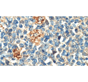 Immunohistochemistry - Anti-PLA2G7 Antibody [IHC407] (A324491) - Antibodies.com