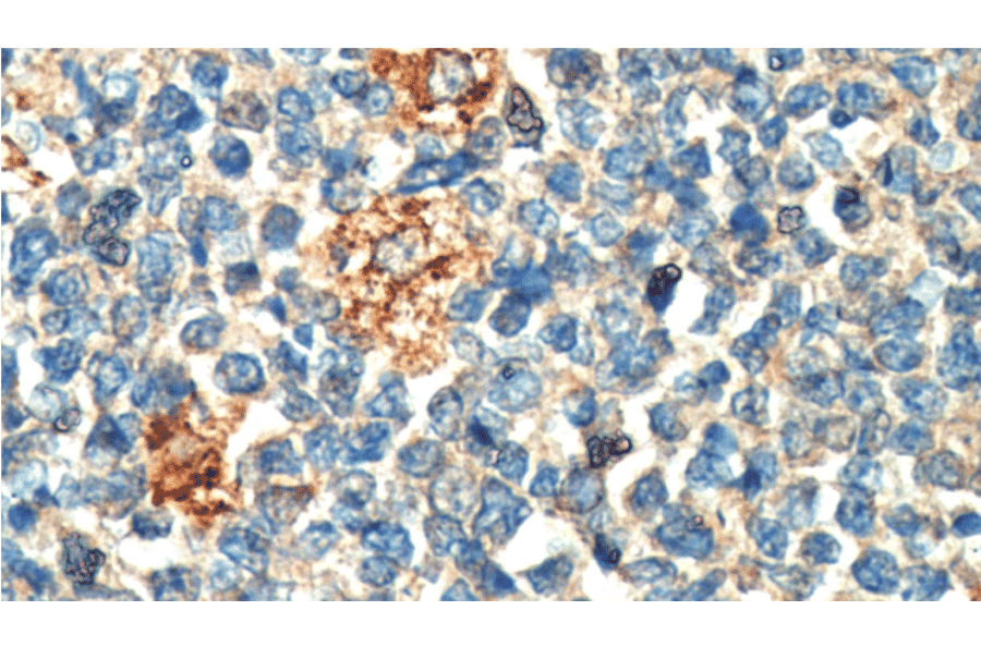 Immunohistochemistry - Anti-PLA2G7 Antibody [IHC407] (A324491) - Antibodies.com
