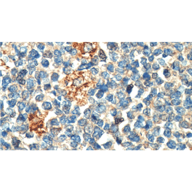 Immunohistochemistry - Anti-PLA2G7 Antibody [IHC407] (A324491) - Antibodies.com