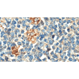 Immunohistochemistry - Anti-PLA2G7 Antibody [IHC407] (A324491) - Antibodies.com
