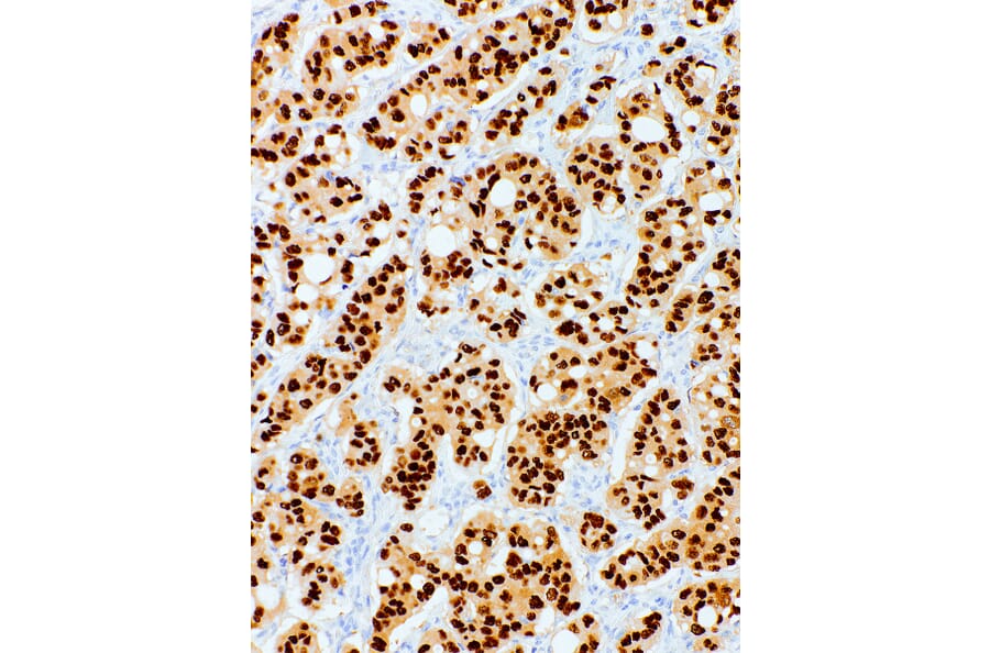 Immunohistochemistry - Anti-Progesterone Receptor Antibody [IHC751] (A324492) - Antibodies.com