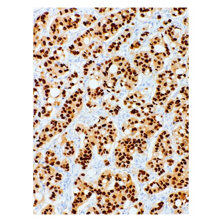 Immunohistochemistry - Anti-Progesterone Receptor Antibody [IHC751] (A324492) - Antibodies.com