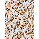 Immunohistochemistry - Anti-Progesterone Receptor Antibody [IHC751] (A324492) - Antibodies.com
