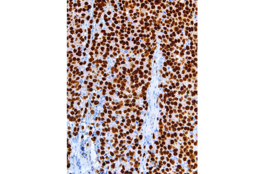 Immunohistochemistry - Anti-Sall4 Antibody [IHC659] (A324493) - Antibodies.com